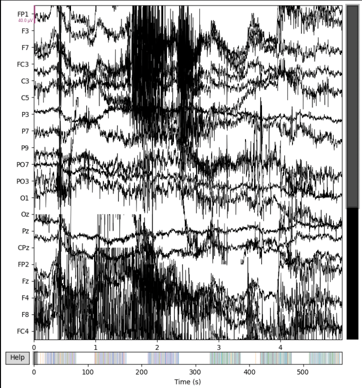 Raw EEG data - Preprocessed/Unfiltered